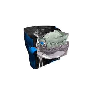 Exocad Software Modul - Icon Dicom Viewer