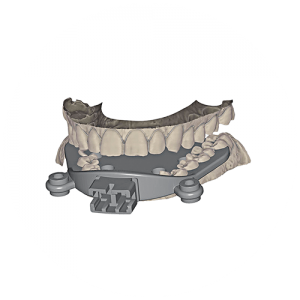 Exocad Software Modul - Jaw Motion