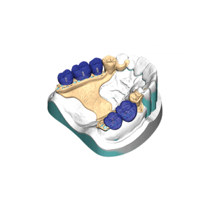 Exocad Software Modul - Partial CAD