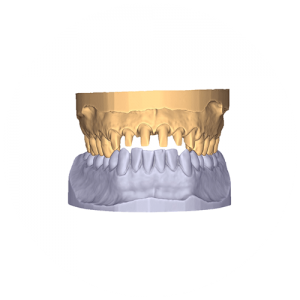 Exocad Software Modul - Smile Creator